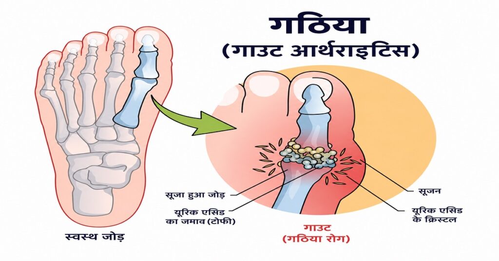 लक्षण जो बताते हैं कि यूरिक एसिड बढ़ा है