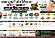 त्वचा एलर्जी और रैशेज का घरेलू इलाज: खुजली और लालिमा से राहत खुजली और लालिमा से राहत के 9 तरीके