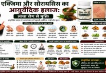 एक्जिमा और सोरायसिस का आयुर्वेदिक इलाज: त्वचा रोग से मुक्ति एक्जिमा और सोरायसिस का आयुर्वेदिक इलाज: त्वचा रोग से मुक्ति