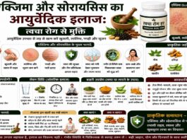 एक्जिमा और सोरायसिस का आयुर्वेदिक इलाज: त्वचा रोग से मुक्ति