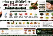 सफेद दाग (विटिलिगो) का आयुर्वेदिक इलाज: त्वचा का रंग वापस लाएं सफेद दाग (विटिलिगो) का आयुर्वेदिक इलाज: त्वचा का रंग वापस लाएं