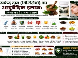 सफेद दाग (विटिलिगो) का आयुर्वेदिक इलाज: त्वचा का रंग वापस लाएं