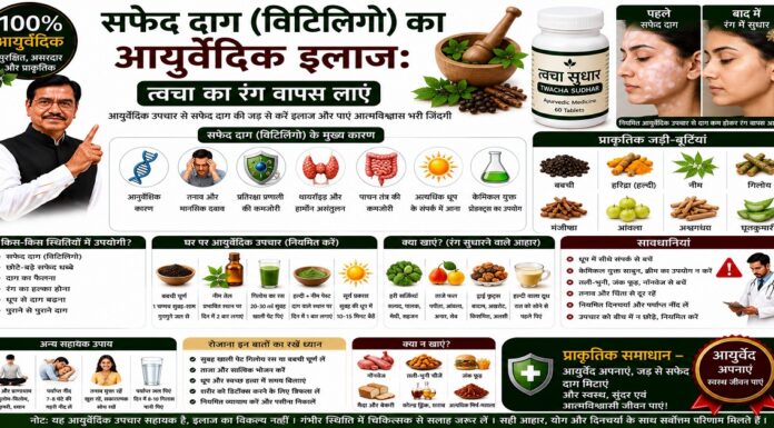 सफेद दाग (विटिलिगो) का आयुर्वेदिक इलाज: त्वचा का रंग वापस लाएं सफेद दाग (विटिलिगो) का आयुर्वेदिक इलाज: त्वचा का रंग वापस लाएं
