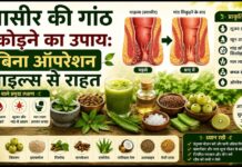 बवासीर की गांठ सिकोड़ने का उपाय: बिना ऑपरेशन पाइल्स से राहत बवासीर की गांठ सिकोड़ने का उपाय: बिना ऑपरेशन पाइल्स से राहत