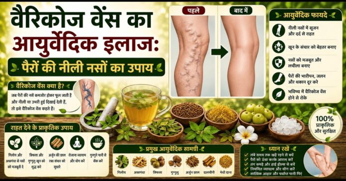वैरिकोज वेंस का आयुर्वेदिक इलाज: पैरों की नीली नसों का उपाय वैरिकोज वेंस का आयुर्वेदिक इलाज: पैरों की नीली नसों का उपाय