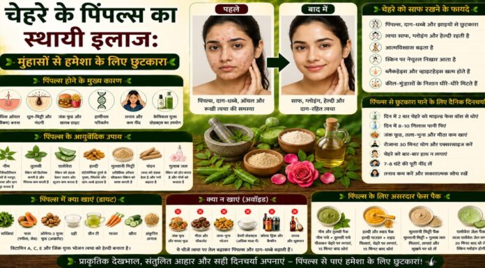 चेहरे के पिंपल्स का स्थायी इलाज: मुंहासों से हमेशा के लिए छुटकारा चेहरे के पिंपल्स का स्थायी इलाज: मुंहासों से हमेशा के लिए छुटकारा