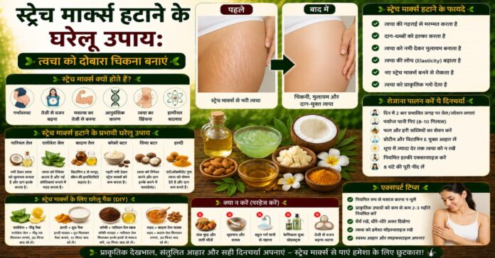 स्ट्रेच मार्क्स हटाने के घरेलू उपाय: त्वचा को दोबारा चिकना बनाएं स्ट्रेच मार्क्स हटाने के घरेलू उपाय: त्वचा को दोबारा चिकना बनाएं