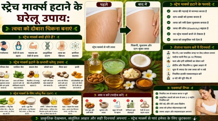 स्ट्रेच मार्क्स हटाने के घरेलू उपाय: त्वचा को दोबारा चिकना बनाएं स्ट्रेच मार्क्स हटाने के घरेलू उपाय: त्वचा को दोबारा चिकना बनाएं